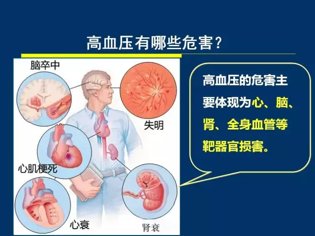 福建省立医院朱鹏立教授:了解并重视高血压